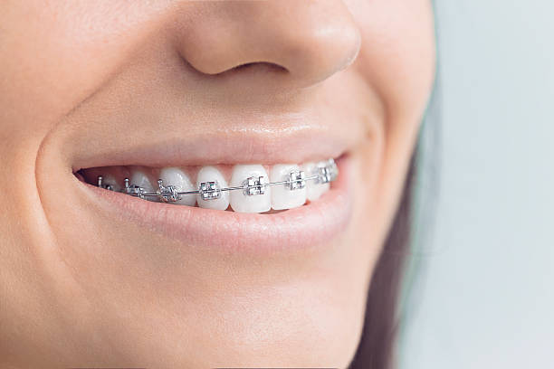 Dental Inlays and Onlays in Lake Heritage, PA
